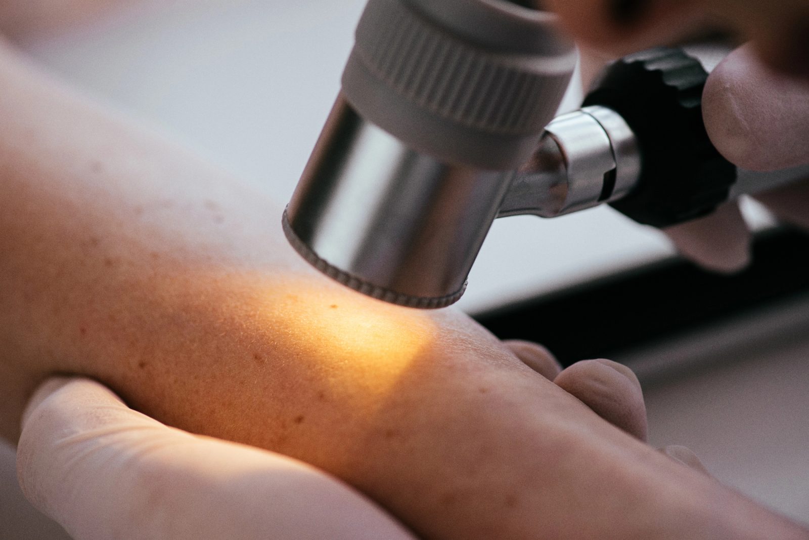 Ko dermatolog postane tudi svetovalec in ne samo zdravnik